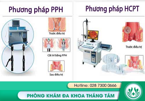 bệnh trĩ phải làm sao