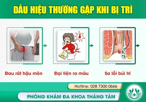 Chảy máu hậu môn có thể do bệnh trĩ