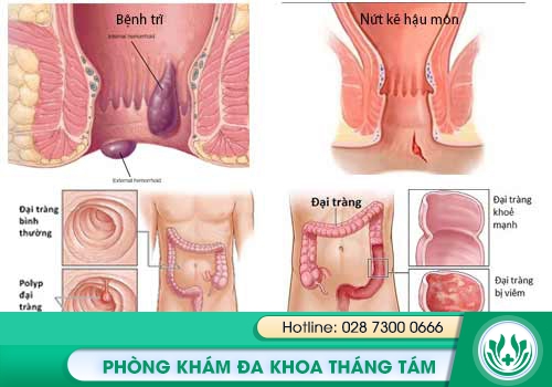 Các nguyên nhân dẫn đến chứng đi cầu ra máu