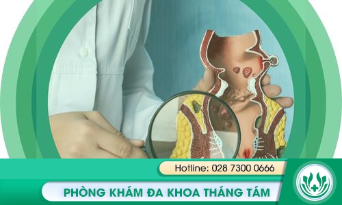 khâm bệnh trĩ ở đâu tốt HCM