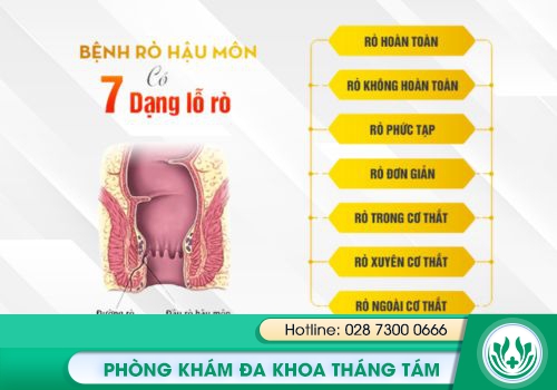 Hình ảnh về bệnh rò hậu môn