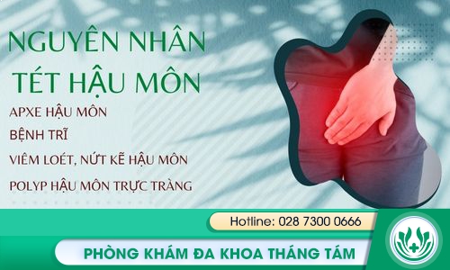 tét hậu môn