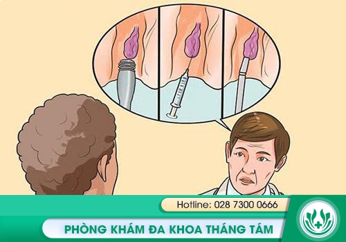 Tư vấn bệnh trĩ miễn phí ở đâu tốt, chính xác